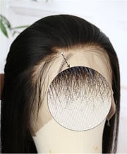 Hairline