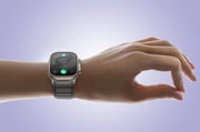 Apple Watch Series 10