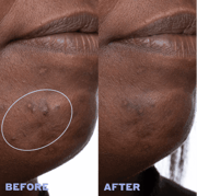 Skin Rhythm™ Balancing & Clearing Serum