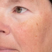 C-Luma™ Hydrabright Serum
