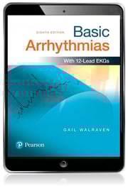 Basic Arrhythmias