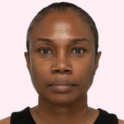 T.L.C. Sukari Babyfacial™ Midi
