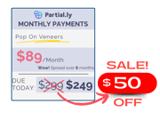 Monthly Payment Plan - Pop On Veneers - $50 Off