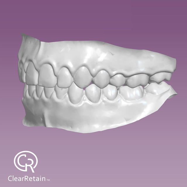 File Your Smile (A Digital Copy of Your Impressions For Future Replacement Products)