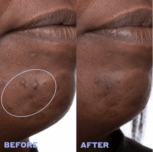 Skin Rhythm™ Balancing & Clearing Serum