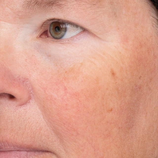 C-Luma™ Hydrabright Serum