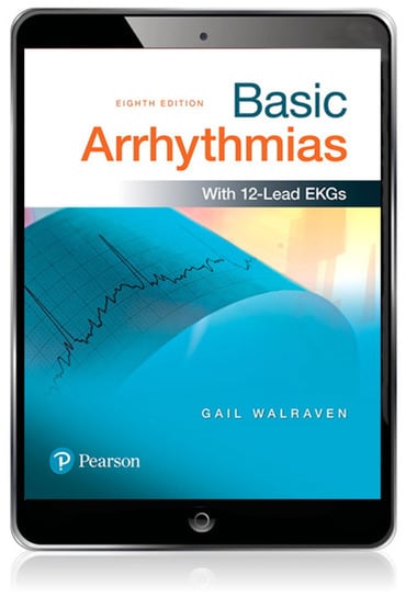 Basic Arrhythmias