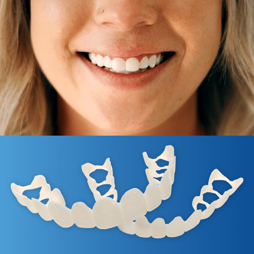 Shiny Smile Snap On Veneers - Custom Made Clip on Veneers - Top & Bottom Set, One Payment, Bright White Color
