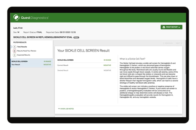 Sickle Cell Trait Blood Test | Sickle Cell Trait Lab Test | Quest®