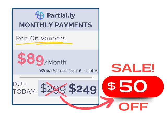 Monthly Payment Plan - Pop On Veneers - $50 Off