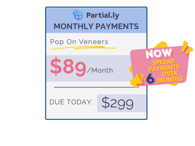 Monthly Payment Plan - Pop On Veneers