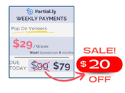 Weekly Payment Plan - Pop On Veneers - $20 Off
