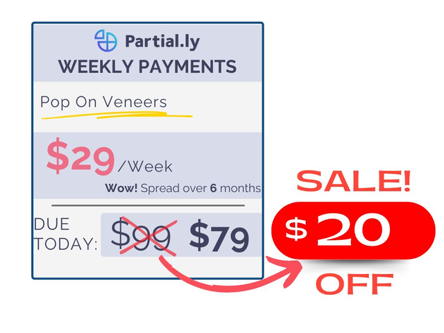 Weekly Payment Plan - Pop On Veneers - $20 Off