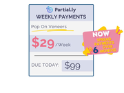 Payment Plan - Pop On Veneers