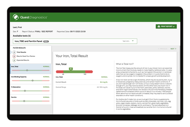 Iron, TIBC & Ferritin Panel