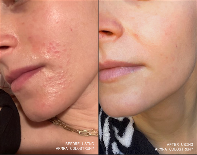 Immune Revival Unflavored Travel Sticks