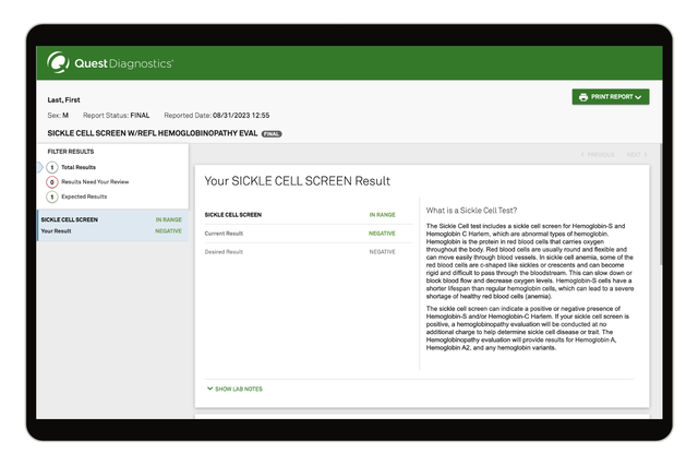 Sickle Cell Trait Blood Test | Sickle Cell Trait Lab Test | Quest®