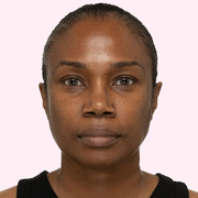 T.L.C. Sukari Babyfacial™ Midi