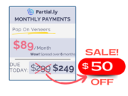 Monthly Payment Plan - Pop On Veneers - $50 Off