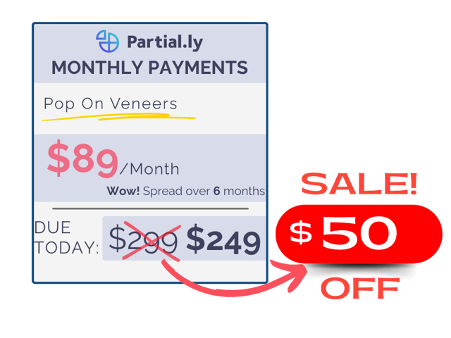 Monthly Payment Plan - Pop On Veneers - $50 Off
