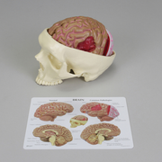 "GPI Anatomicals&reg; Human Brain Model in Skull with Pathologies"