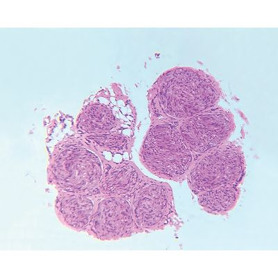 "Nerve, cross section, Microscope Slide"