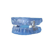 Oral Appliance for Sleep Apnea - Mezzo Lateral