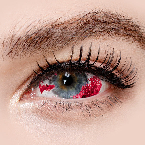 Princess Pinky Vessel Burst Sclera